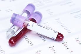 Triễn khai lấy máu làm xét nghiệm sàng lọc HIV, viêm gan B và giang mai cho phụ nữ có thai năm 2020