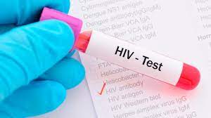 Hướng dẫn xét nghiệm nhiễm mới HIV