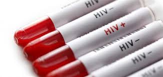 Tăng cường các hoạt động dự phòng lây nhiễm HIV, xét nghiệm phát hiện sớm trên địa bàn huyện Việt...