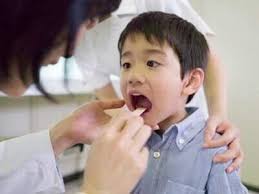 Phòng bệnh viêm mũi họng cho trẻ