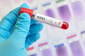 Phòng chống cúm A/H1N1